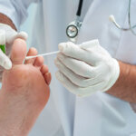 antifongique pour les ongles