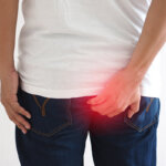 crème pour hémorroïdes